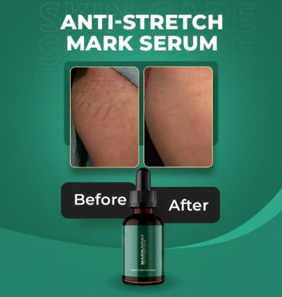 Markaway Stretch Mark Serum (30ml)