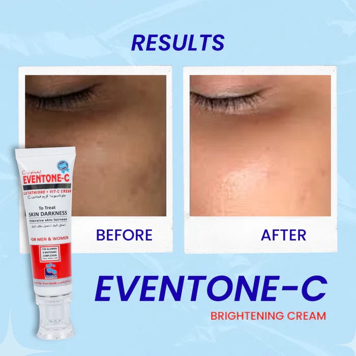 Eventone-C Brightening Cream