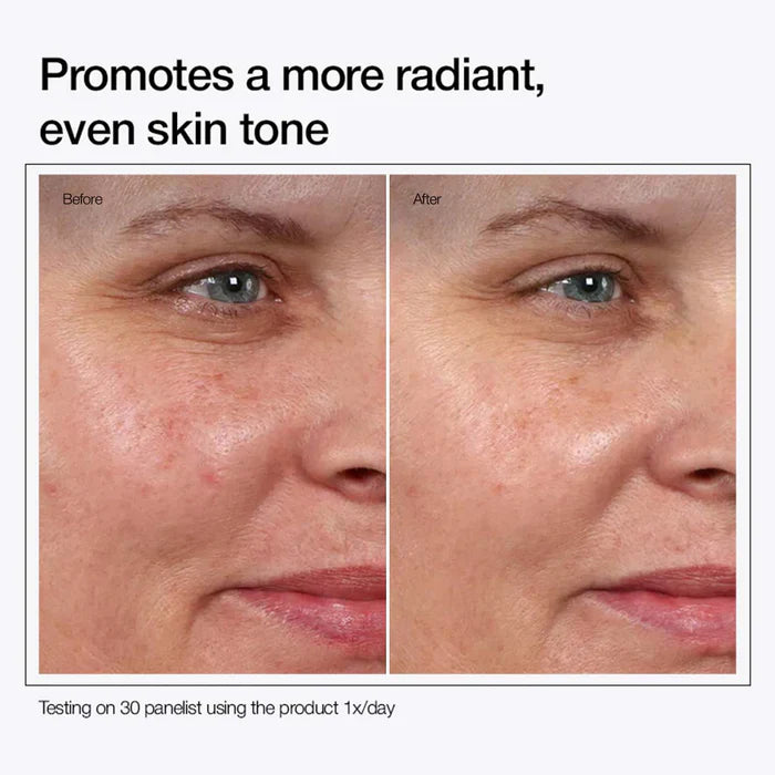 Urapra Glycolic Acid (100 ml)