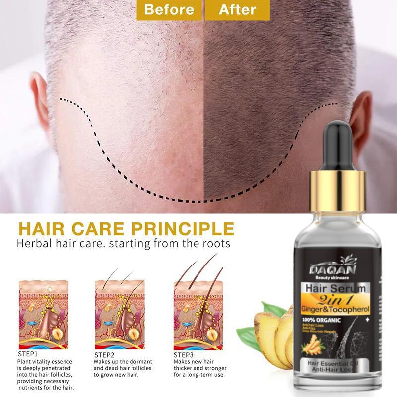 Anti Hair Loss Serum